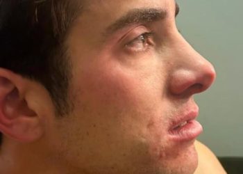 Garín desabafa após desclassificação na Copa Davis: “Árbitro queria que eu jogasse com tontura”