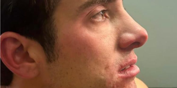 Garín desabafa após desclassificação na Copa Davis: “Árbitro queria que eu jogasse com tontura”